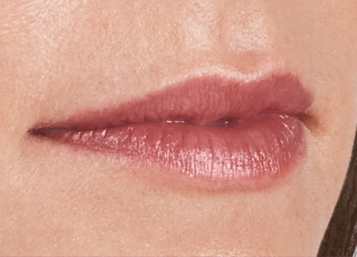 Volbella Before Volbella Before